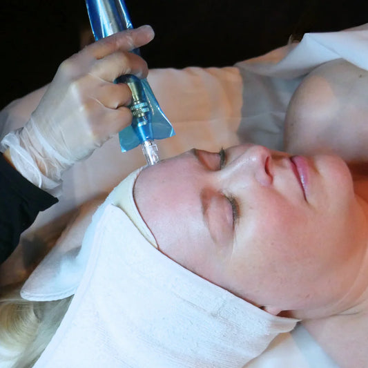 Microneedling (Collagen Induction Therapy)