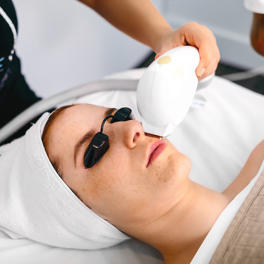 IPL PhotoRejuvenation Treatment