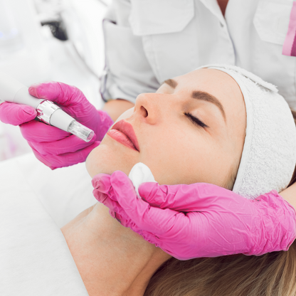 Microneedling