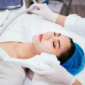 IPL Acne Facial