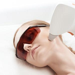 IPL Rosacea Facial